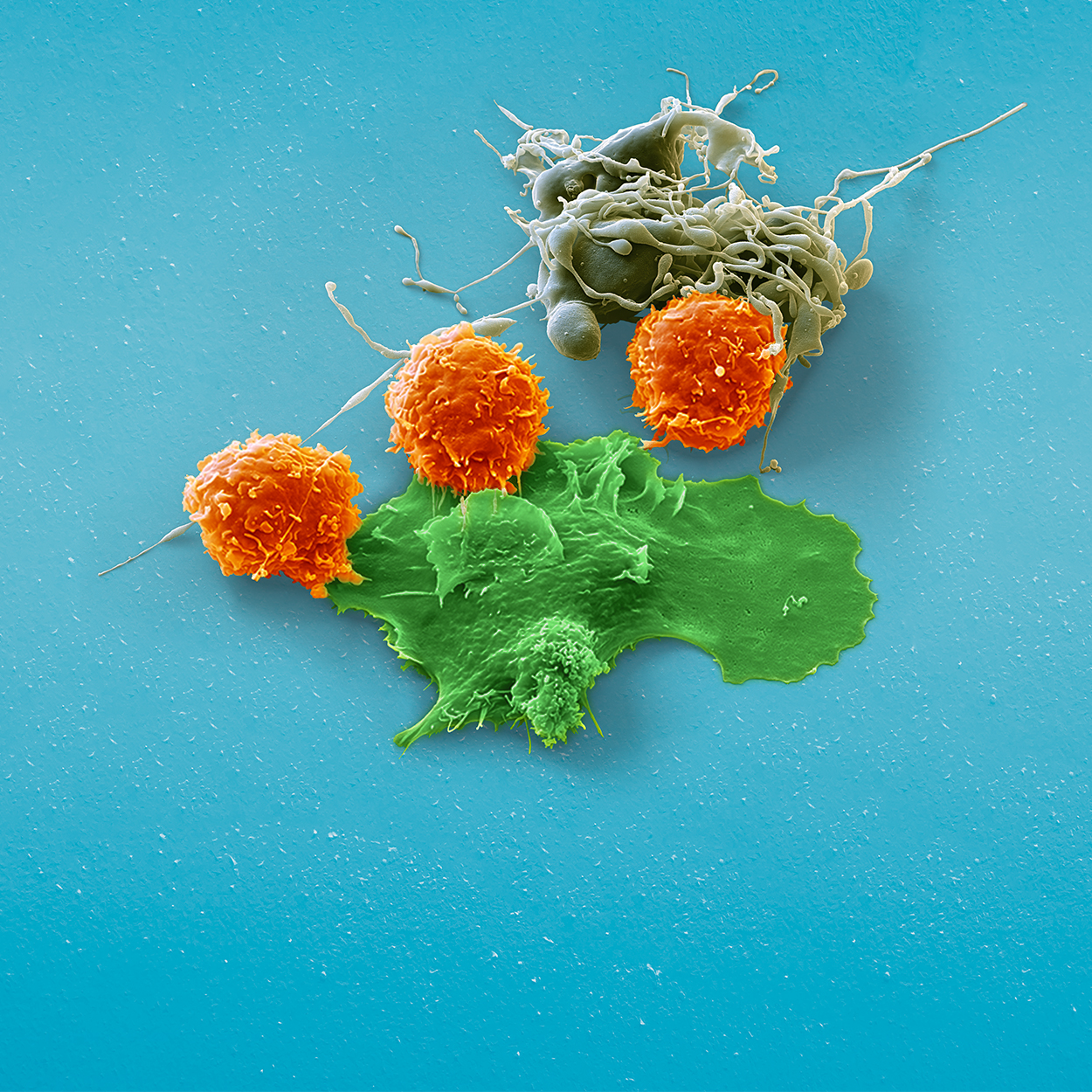 <strong>Engineered NK cell manufacturing</strong>